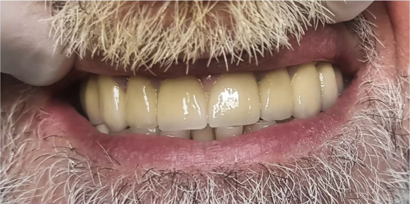 After: the restored smile