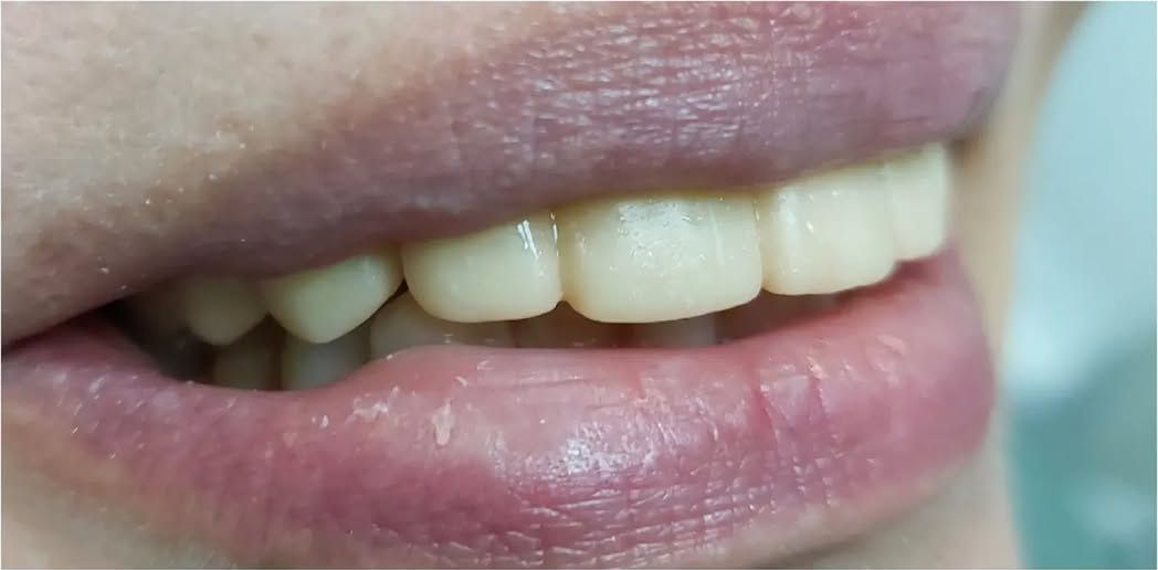 Before: a smile before treatment