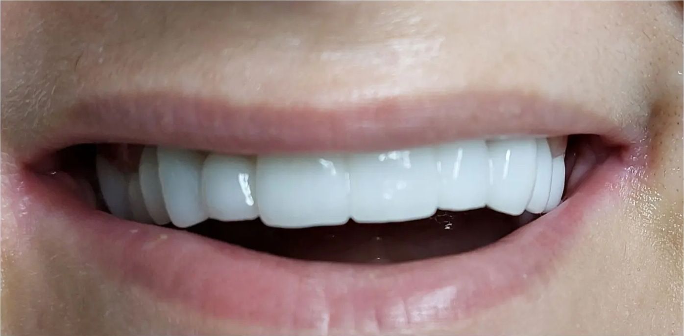 After: the restored smile