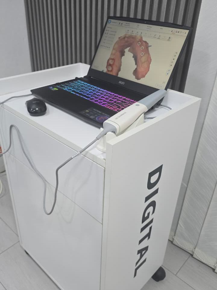 An intraoral scanner beside a laptop showing a digital scan of the teeth